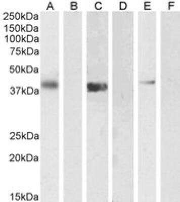 Western Blot: PTF1A Antibody [NB100-60953]