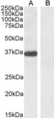 Western Blot: PTF1A Antibody [NB100-60953]