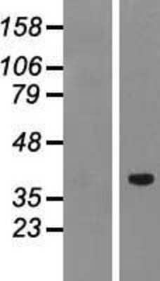 Western Blot: PTF1A Overexpression Lysate [NBP2-04988]