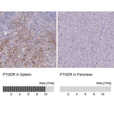 Immunocytochemistry/ Immunofluorescence: PTGDR Antibody [NBP3-17064]