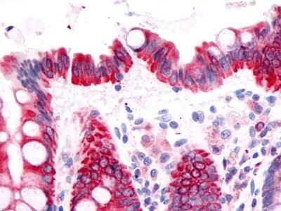 Immunohistochemistry-Paraffin: PTGDR Antibody - BSA Free [NLS3279]