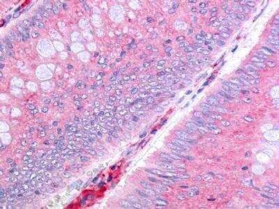 Immunohistochemistry-Paraffin: PTGDR Antibody - BSA Free [NLS503]