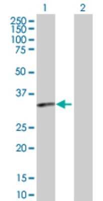 Western Blot: PTGDR Antibody [H00005729-D01P]