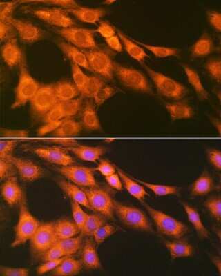 Immunocytochemistry/ Immunofluorescence: PTGER2 Antibody (2G10L6) [NBP3-16740]