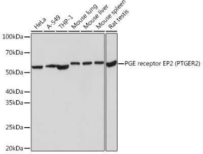 Western Blot: PTGER2 Antibody (2G10L6) [NBP3-16740]