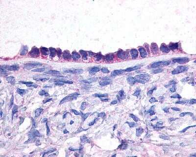 Immunohistochemistry-Paraffin: PTGER2 Antibody - BSA Free [NLS971]