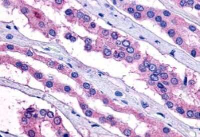 Immunohistochemistry-Paraffin: PTGER2 Antibody - BSA Free [NLS971]