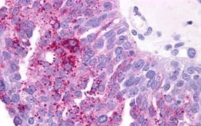 Immunohistochemistry: PTGER3 Antibody [NBP3-14452]