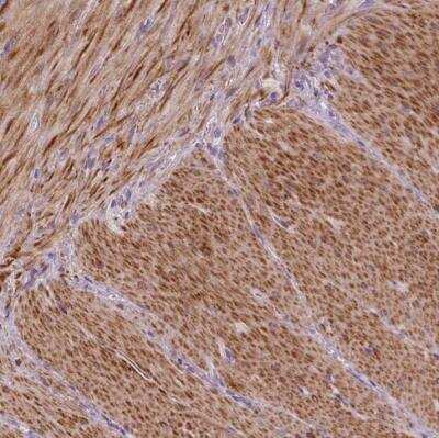 Immunohistochemistry-Paraffin: PTGER3 Antibody [NBP1-84835]