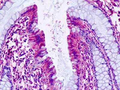 Immunohistochemistry-Paraffin: PTGER4/EP4 Antibody - BSA Free [NLS3896]