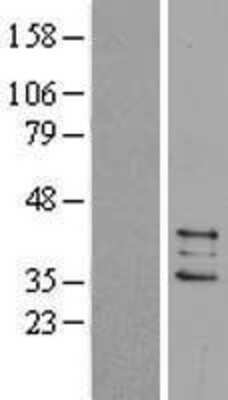 Western Blot: Prostaglandin E Synthase 2/PTGES2 Overexpression Lysate [NBL1-14936]