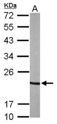 Western Blot: p23/PTGES3 Antibody [NBP2-19999]