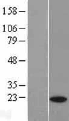 Western Blot: p23/PTGES3 Overexpression Lysate [NBL1-14937]