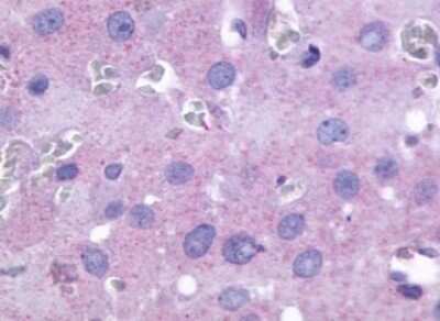 Immunohistochemistry-Paraffin: PTGFR Antibody - BSA Free [NLS1048]