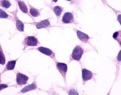 Immunohistochemistry-Paraffin: PTGFR Antibody - BSA Free [NLS1049]