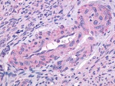 Immunohistochemistry-Paraffin: PTGFR Antibody - BSA Free [NLS1049]