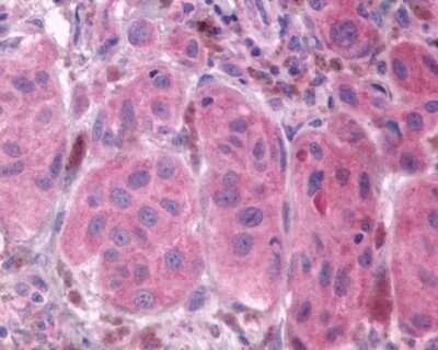 Immunohistochemistry-Paraffin: PTGFR Antibody - BSA Free [NLS1049]