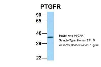 Western Blot: PTGFR Antibody [NBP2-82318]