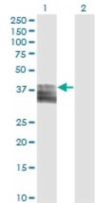 Western Blot: PTGIR Antibody (2A7) [H00005739-M02]