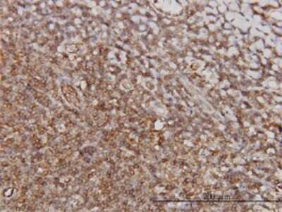 Immunohistochemistry-Paraffin: PTGIR Antibody (4B10) [H00005739-M01]
