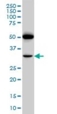Western Blot: PTGIR Antibody (4B10) [H00005739-M01]
