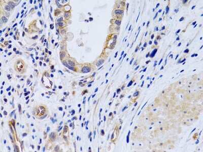 Immunohistochemistry-Paraffin: PTGIR Antibody - BSA Free [NBP2-93654]