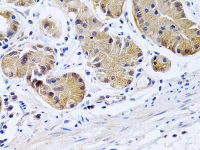 Immunohistochemistry-Paraffin: PTGIR Antibody - BSA Free [NBP2-93654]