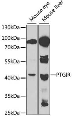 Western Blot: PTGIR AntibodyBSA Free [NBP2-93654]