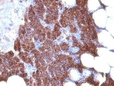 Immunohistochemistry-Paraffin: PTH Antibody (3H9 + PTH/1175) - C-terminus, N-terminal - Azide and BSA Free [NBP2-47731]