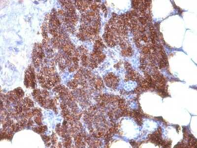 Immunohistochemistry-Paraffin: PTH Antibody (3H9 + PTH/1175) - C-terminus, N-terminal - IHC-Prediluted [NBP2-48404]