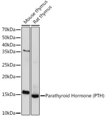 Western Blot: PTH Antibody (5X6R6) [NBP3-16862]