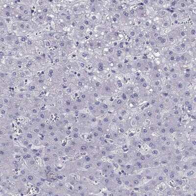 Immunohistochemistry-Paraffin: PTH Antibody [NBP2-55612]