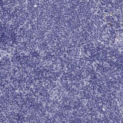 Immunohistochemistry-Paraffin: PTH Antibody [NBP2-55612]