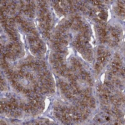 Immunohistochemistry-Paraffin: PTH Antibody [NBP2-55612]