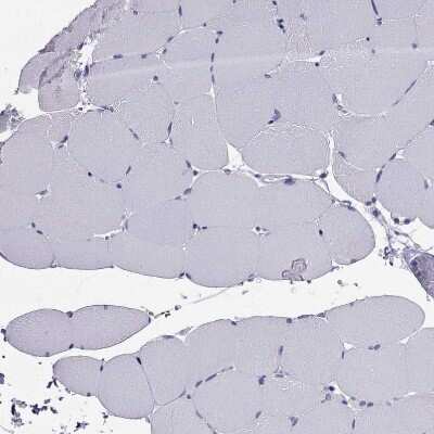 Immunohistochemistry-Paraffin: PTH Antibody [NBP2-55612]