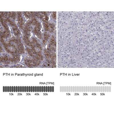 Immunohistochemistry-Paraffin: PTH Antibody [NBP2-55612]