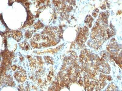 Immunohistochemistry-Paraffin: PTH Antibody (PTH/1173) - C-terminus [NBP2-45113]