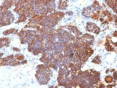 Immunohistochemistry-Paraffin: PTH Antibody (PTH/1173) - C-terminus [NBP2-45113]