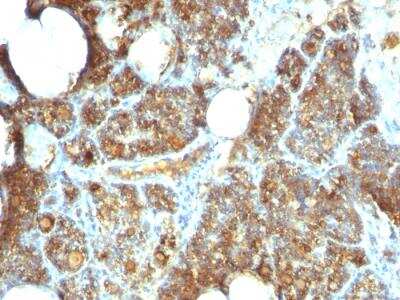 Immunohistochemistry-Paraffin: PTH Antibody (PTH/1173) - C-terminus - IHC-Prediluted [NBP2-48387]
