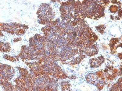 Immunohistochemistry-Paraffin: PTH Antibody (PTH/1174) - C-terminus - Azide and BSA Free [NBP2-47729]