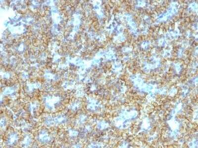 Immunohistochemistry-Paraffin: PTH Antibody (PTH/1174) - C-terminus [NBP2-45114]