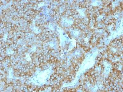 Immunohistochemistry-Paraffin: PTH Antibody (PTH/1175) - C-terminus - Azide and BSA Free [NBP2-47730]