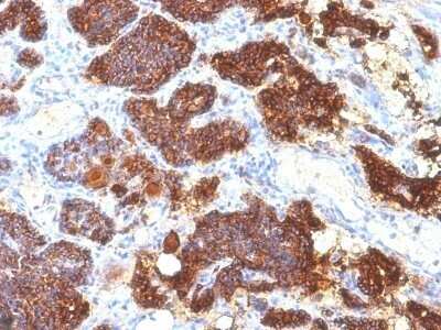 Immunohistochemistry-Paraffin: PTH Antibody (PTH/1175) - C-terminus [NBP2-45115]