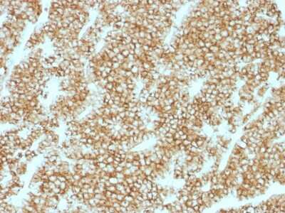 Immunohistochemistry-Paraffin: PTH Antibody (PTH/1717R) - N-terminal - Azide and BSA Free [NBP2-54474]