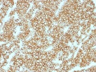 Immunohistochemistry-Paraffin: PTH Antibody (PTH/1717R) - N-terminal [NBP2-53170]