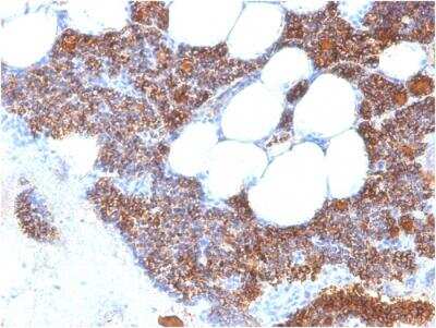 Immunohistochemistry-Paraffin: PTH Antibody (PTH/2295R) - N-terminal - Azide and BSA Free [NBP2-79894]