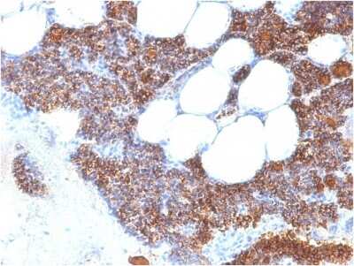 Immunohistochemistry-Paraffin: PTH Antibody (PTH/2295R) - N-terminal [NBP2-79759]