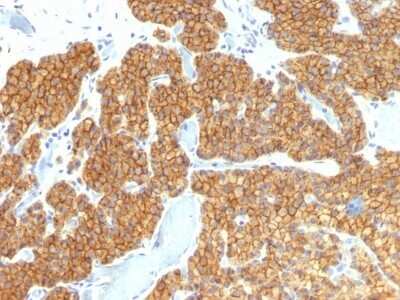 Immunohistochemistry-Paraffin: PTH Antibody (PTH/911) - N-terminal - Azide and BSA Free [NBP2-54433]