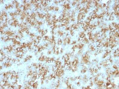 Immunohistochemistry-Paraffin: PTH Antibody (PTH/911) - N-terminal - Azide and BSA Free [NBP2-54433]