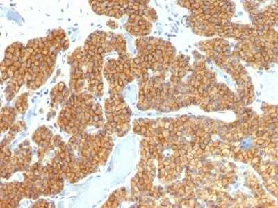 Immunohistochemistry-Paraffin: PTH Antibody (PTH/911) - N-terminal - IHC-Prediluted [NBP2-48385]